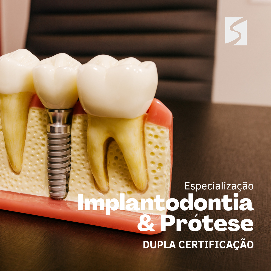 Implantodontia e Protese 