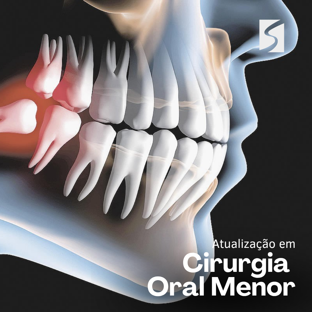 Cirurgia Oral Menor 