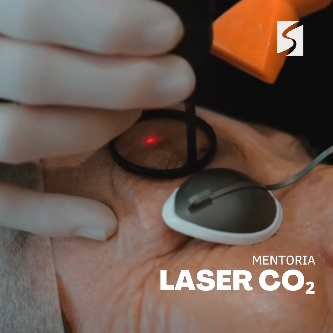 LASER CO₂